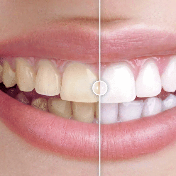 Before & After Image Comparison – Ultimate WordPress Plugin